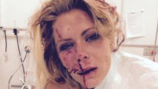 Denmark: Muslims get two months in prison for whipping woman in the face with iron chains