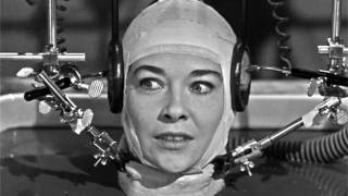 Human head transplants: are we close to making them a reality?