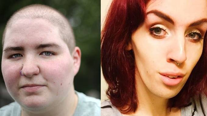 Transgender people face alarmingly high risk of suicide