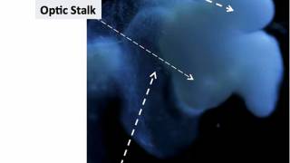 First almost fully-formed human brain grown in lab, researchers claim