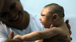 Zika virus: 3 more US babies born with birth defects