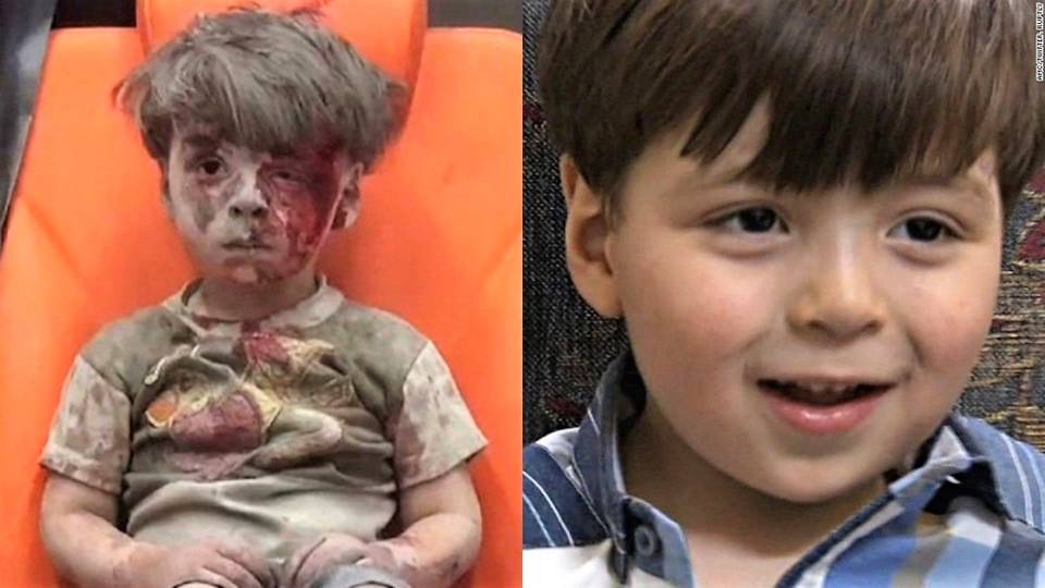 Omran Daqneesh, Aleppo's Bloodied Boy, Shown in new Images