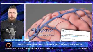 Transhumanism: Brain Implant Enables Man To Tweet Using Only His Thoughts