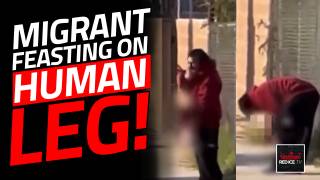 Migrant Feasting On Human Leg